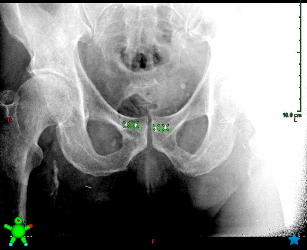 Fiducial Marker Match